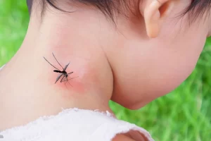 A mosquito is biting a kid